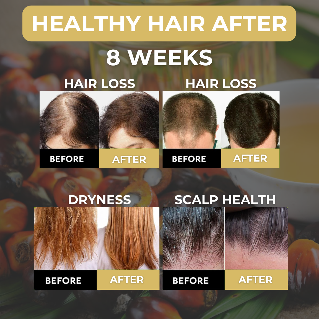 Batana Essential Hair Oil - For Hair Growth & Skin Care
